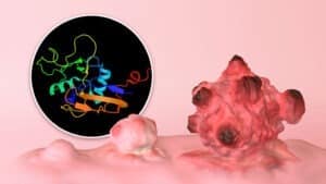 Mexicanos desarrollan molécula que reduce tumores y metástasis de cáncer de mama.