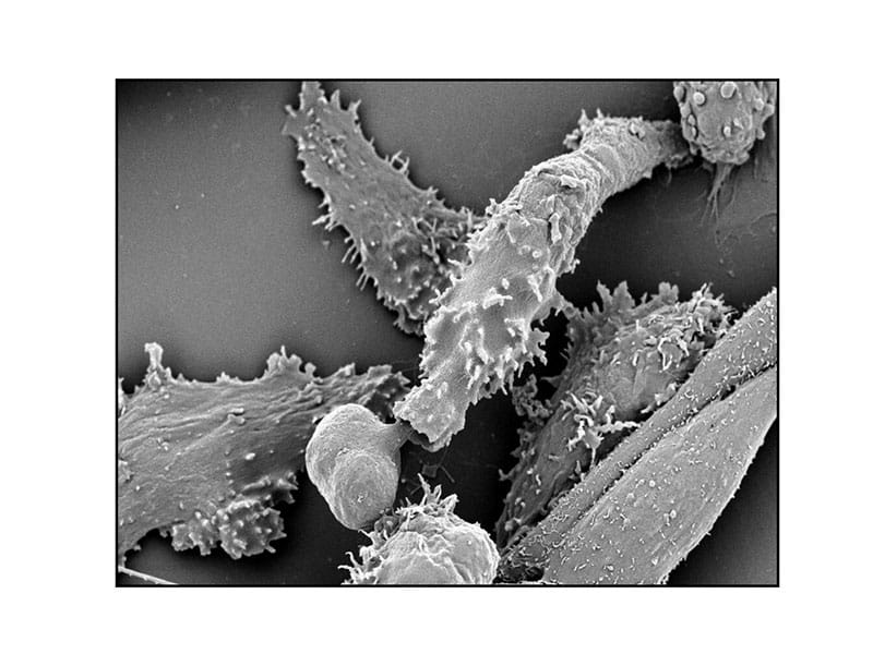 ¡Orgullo mexicano! Crean tratamiento natural contra amibas - Dirmedal ...