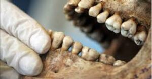 Investigan robo de 4 mil cadáveres en crematorios para tratamientos dentales ilegales.