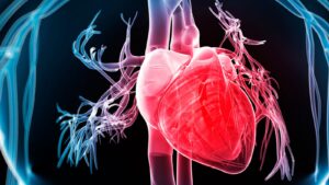 infartos