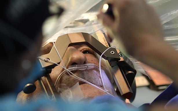 Disminución del olfato y problemas gastrontestinales también son señales de Parkinson