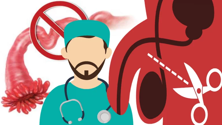 5 VERDADES de la anticoncepción permanente (para hombres y mujeres)