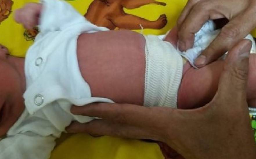 ¿Debes fajar el ombligo de tu bebé? Expertos dan respuesta urgente