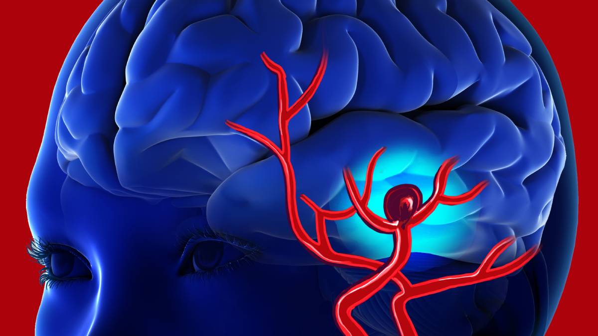 Hombre de 39 años sufrió ruptura de aneurisma cerebral y su familia toma difícil decisión