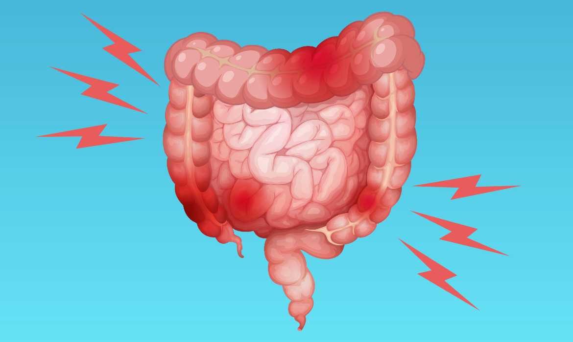 ¿Acudes más de diez veces por día? Cuidado con tu intestino