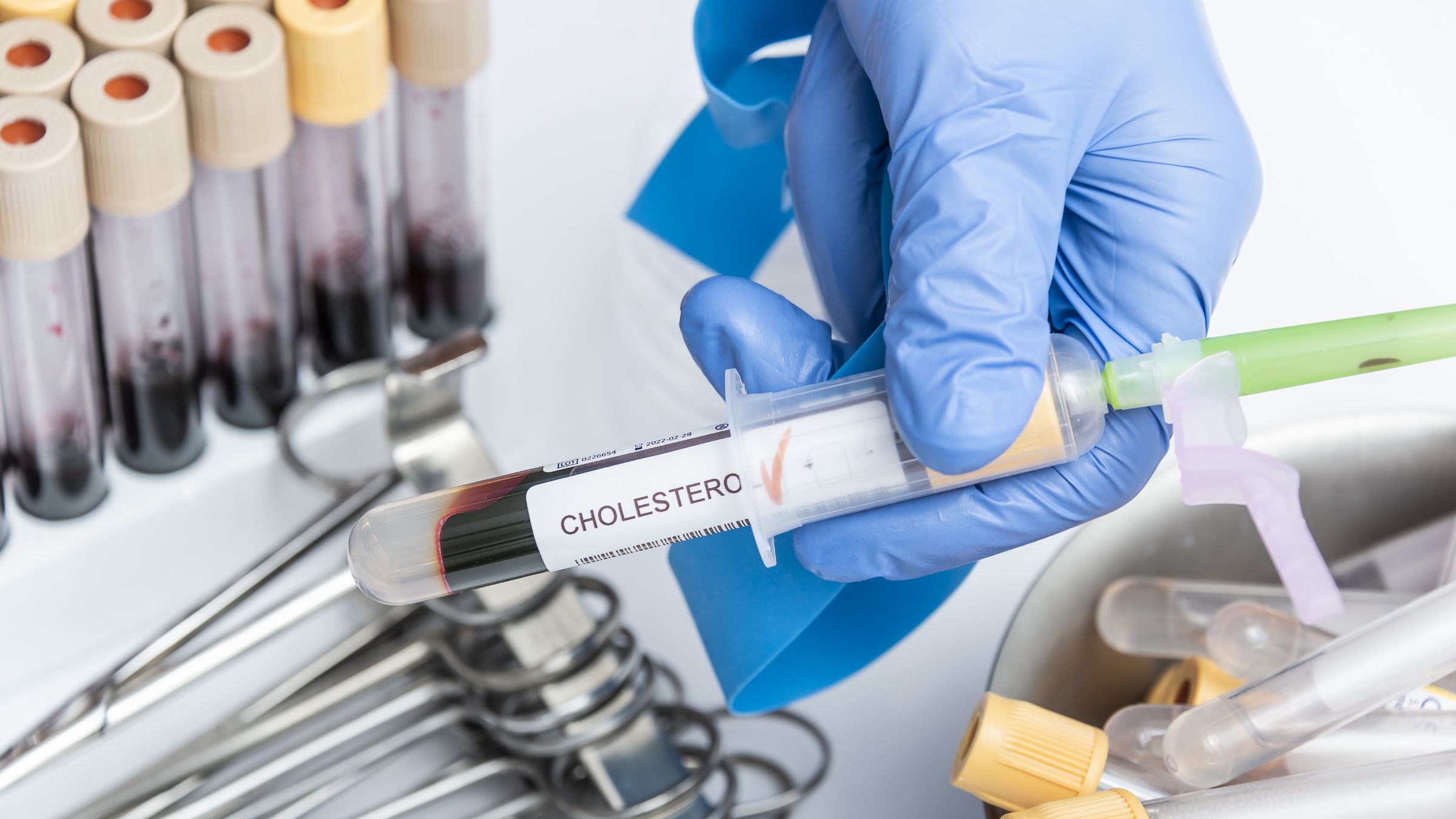 Estudio demuestra que la combinación de dos medicamentos reduce colesterol “malo” y triglicéridos de forma segura: ¿cuál es?