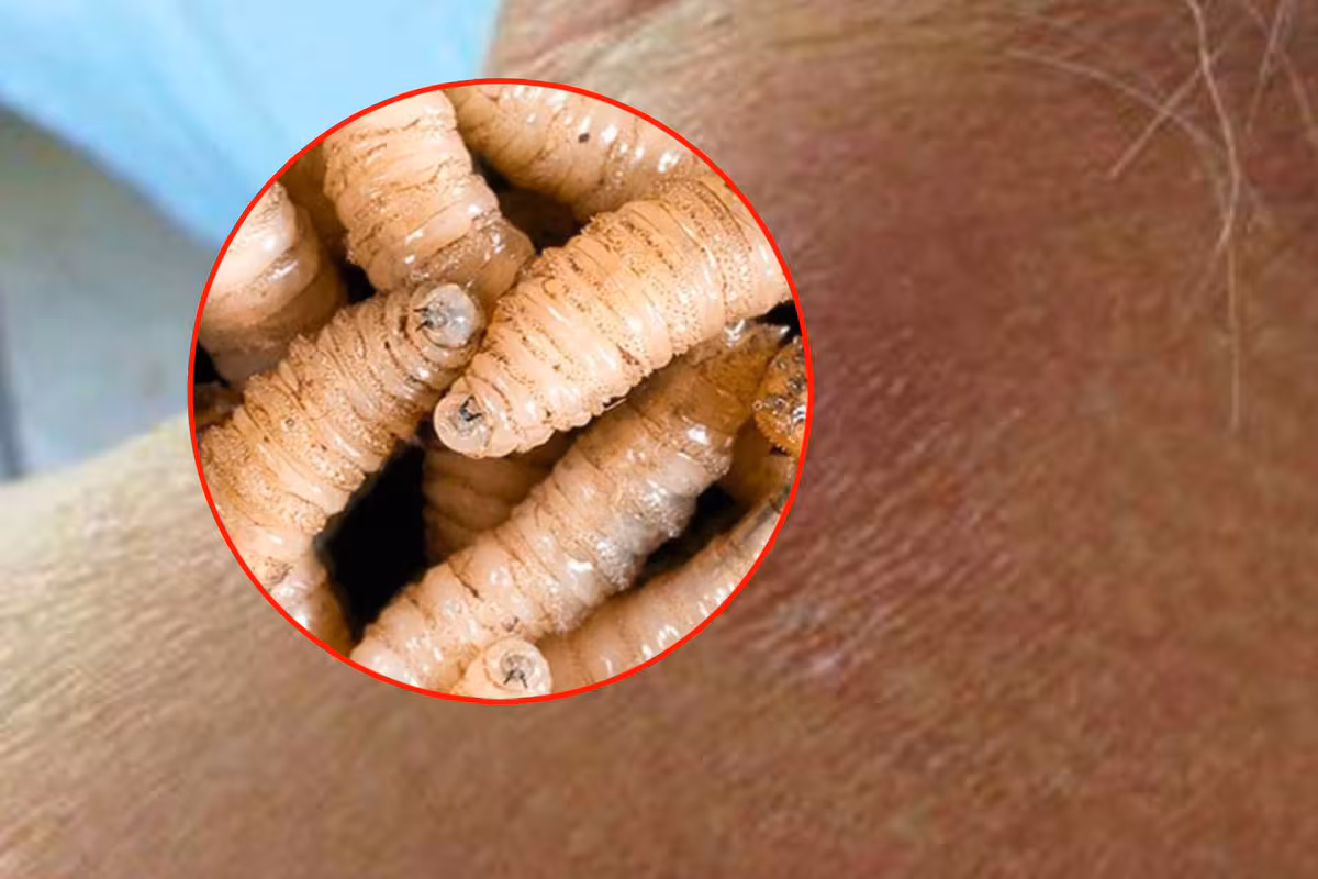 Confirman primera muerte humana por gusano barrenador en México