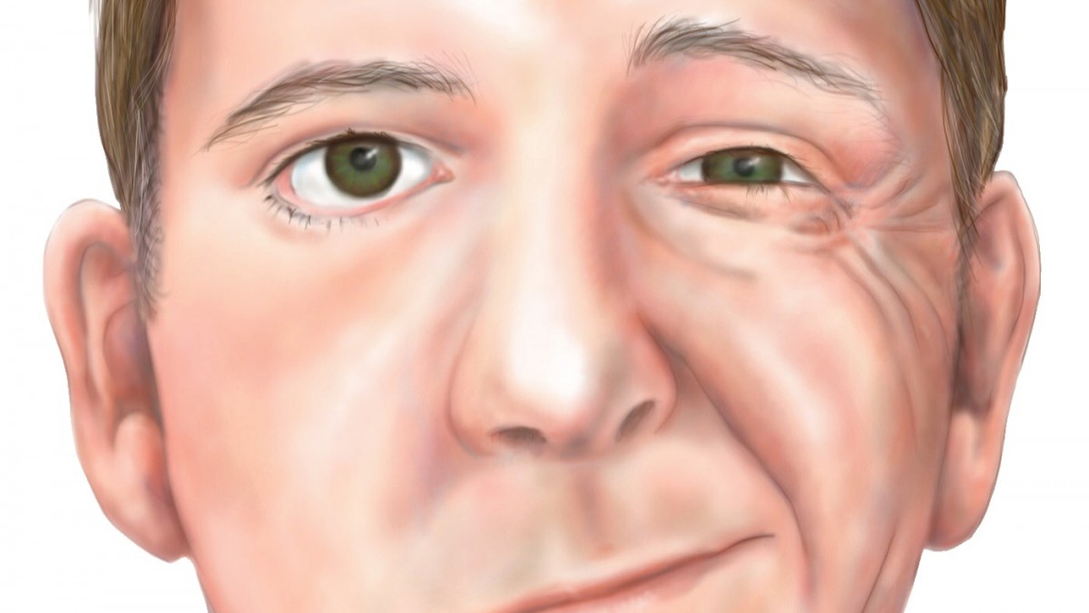 ¿Dificultades para hablar y boca desviada? Descubre 5 hábitos para un cerebro saludable