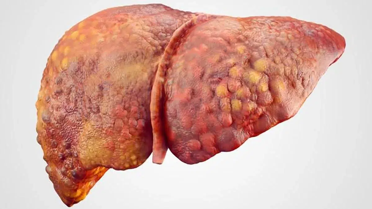Mexicanos encuentran marcadores biológicos para identificar enfermedades del hígado antes de sus primeros síntomas