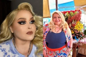 Sheyla donó 9 kilos de piel para personas con quemaduras: ¿cómo es la donación de piel?