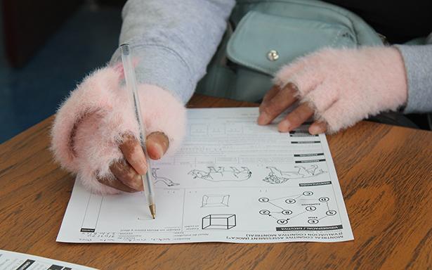 Disminución de la circulación en los dedos puede ser el primer síntoma de esclerodermia, ¿qué es?