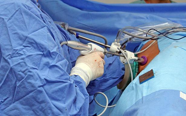 En cinco semanas especialistas mexicanos realizaron 30 trasplantes de riñón