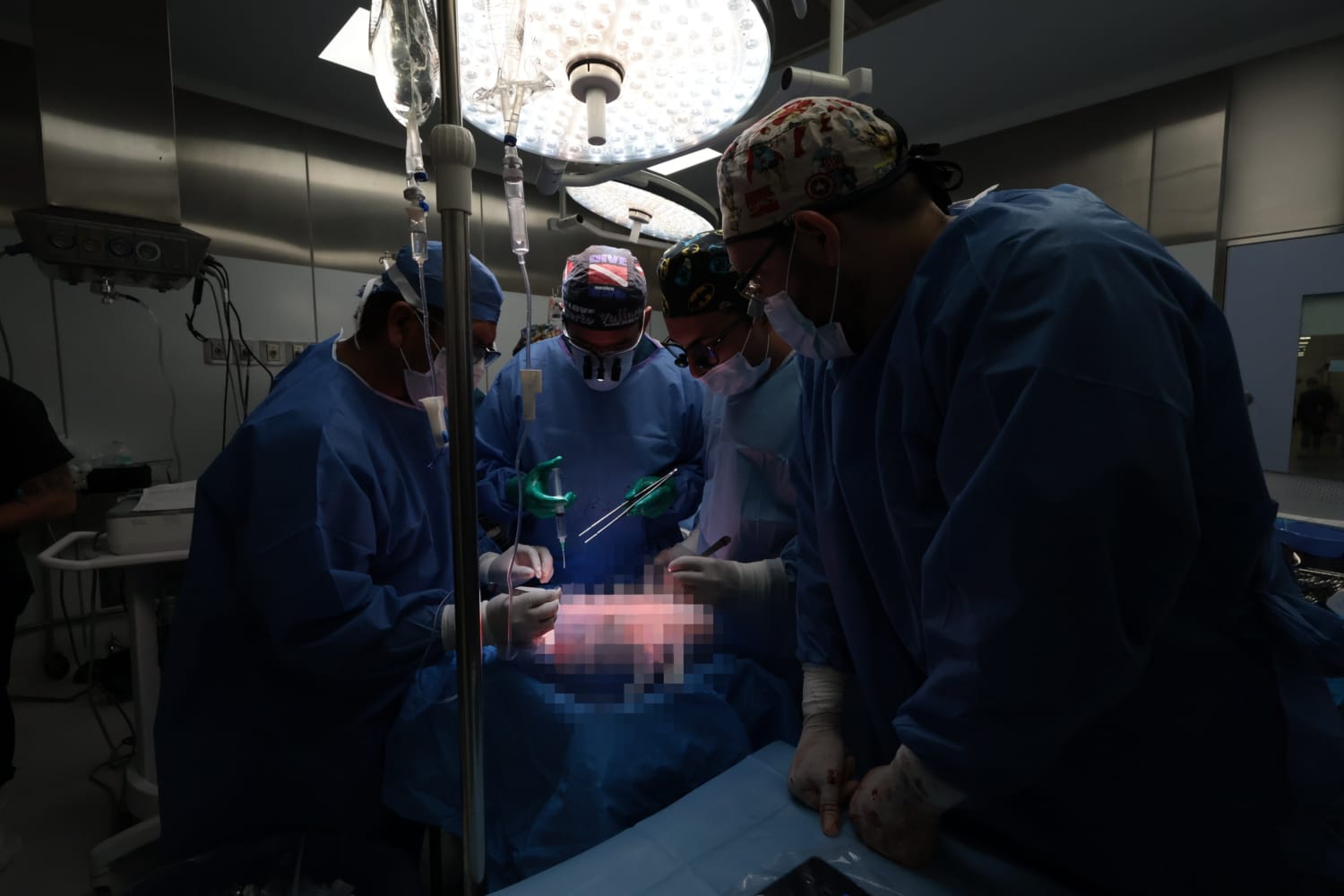 ISSSTE Jalisco realiza primer trasplante hepático a niño de tres años