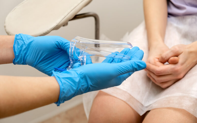 ¿Eres mujer de 25 años? Ya necesitas una prueba de Papanicolaou para detectar lesiones precancerosas