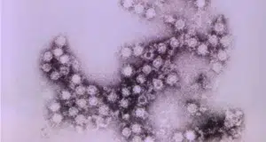 alerta en Campeche por propagacion del virus Coxsacke