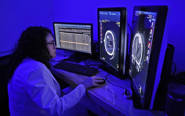 Existe un medicamento que puede disolver  coágulos que provocan infartos cerebrales, ¿cuál es?