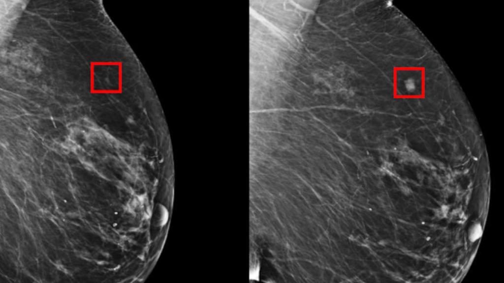 Instalan mastógrafo en oficinas nacionales de la CFE para revisiones a trabajadoras