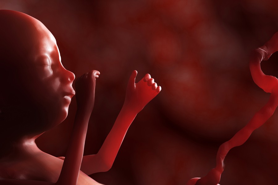 INPer atiende uno de cada 10 casos de espina bífida en México