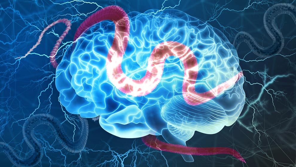 Dolores de cabeza crónicos y hasta crisis de epilepsia pueden ser señales de parásitos en el cerebro