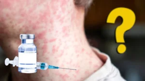 Gobierno de México asegura que el abasto necesario para combatir el sarampión está garantizado