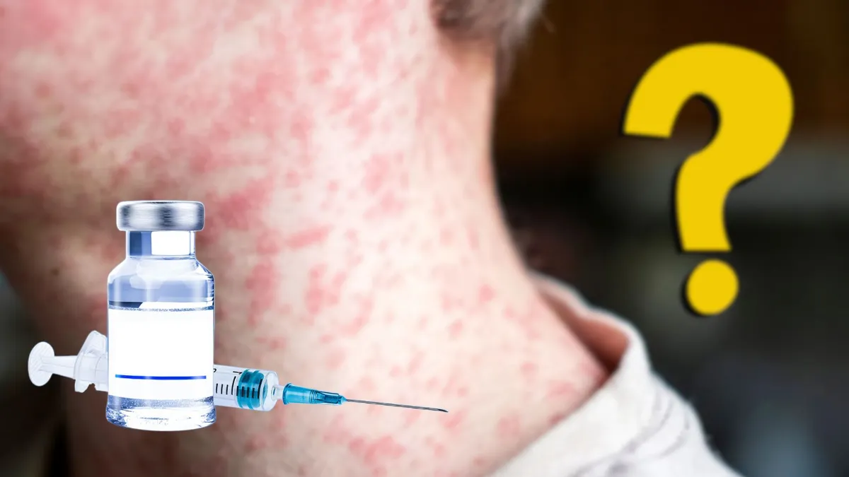 Gobierno de México asegura que el abasto necesario para combatir el sarampión está garantizado