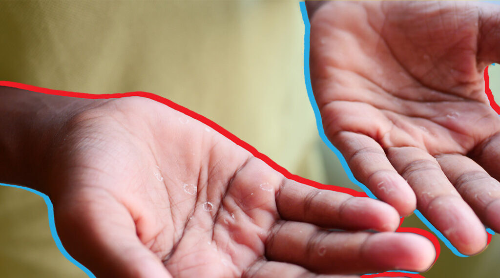 Estigma sigue siendo una de las principales barreras en la respuesta al VIH en México