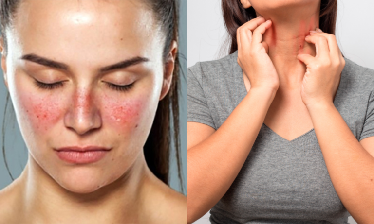 UABC será sede del Congreso Internacional “Potencia Lupus 2026”