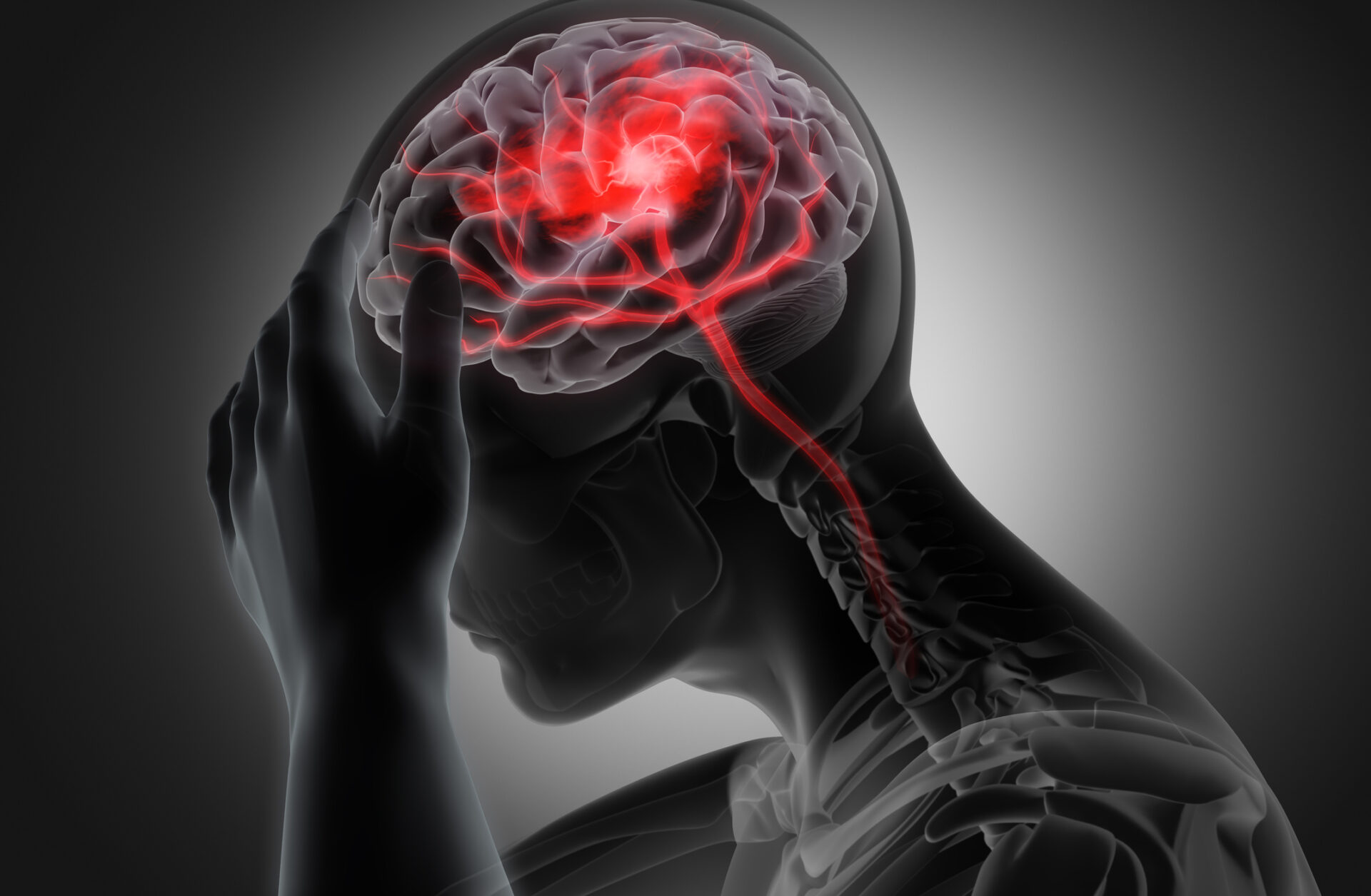 ISSSTE en Puebla obtiene reconocimiento internacional por atención de enfermedad vascular cerebral
