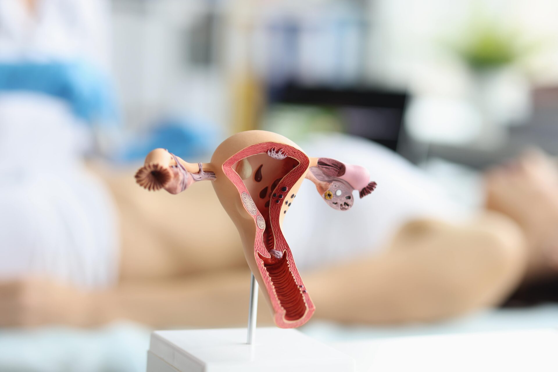 Atienden con éxito raro caso ginecológico: “implicaba el desplazamiento de órganos abdominales”