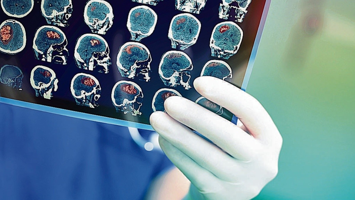 INPRFM trabaja en identificar genes que causan trastornos neuropsiquiátricos en México