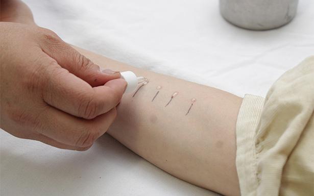 IMSS ya cuenta con servicio especializado para alergias en niñas, niños y adolescentes
