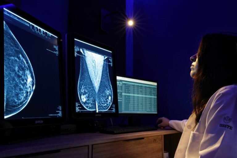 Anuncian quinto “cuarto azul” del ISSSTE para diagnóstico de cáncer de mama mediante IA