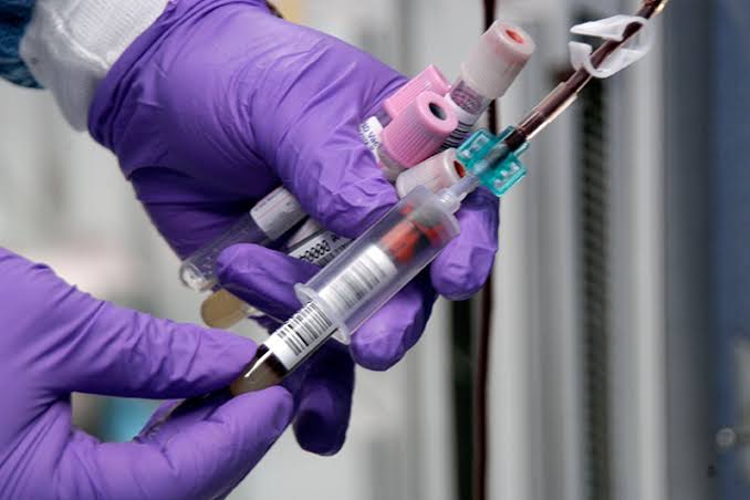 México apuesta por la aplicación de la biopsia líquida  para tratar el cáncer de forma menos invasiva