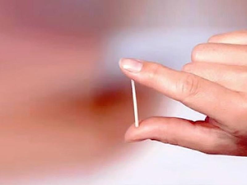 OMS apoya uso de implantes anticonceptivos durante un máximo de 5 años