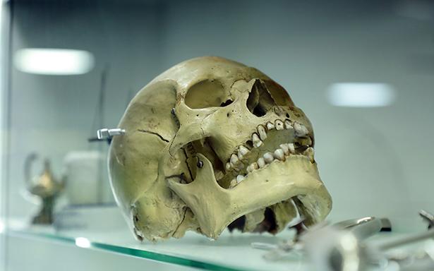 IMSS incorpora herramientas digitales e impresión 3D en cirugía maxilofacial