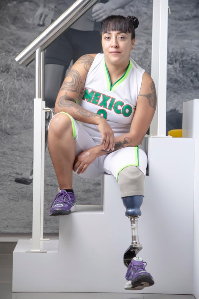 Solo el 15% de los pacientes con amputación en México recibe apoyo en salud mental