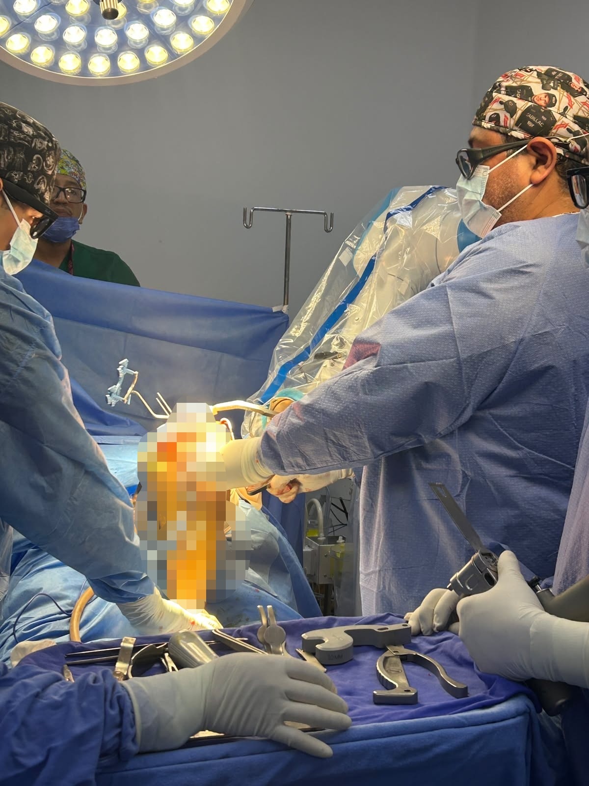 ISSSTE en Morelos realiza con éxito primeras 13 cirugías de rodilla con robot ROSA